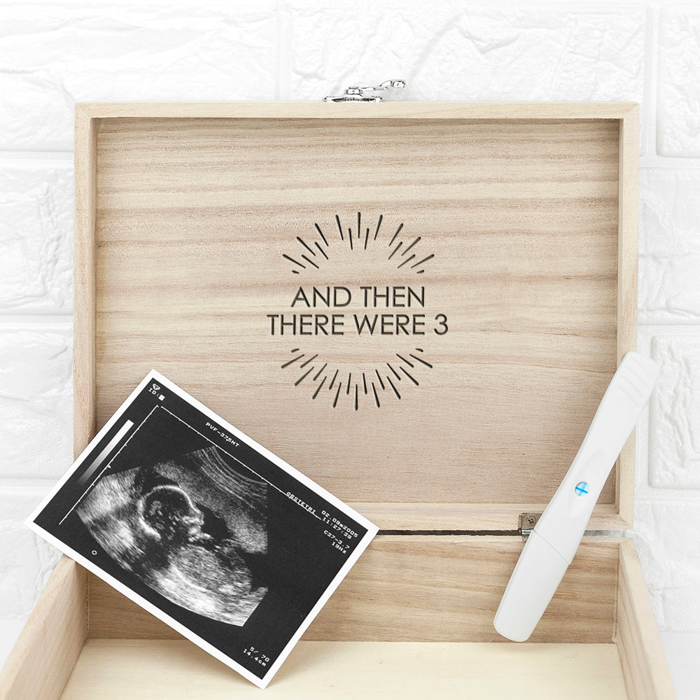 Personalised Surprise Announcement Box